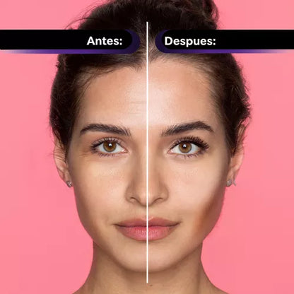 Imagina recibir cumplidos todos los días ✨El nuevo Botox!!!